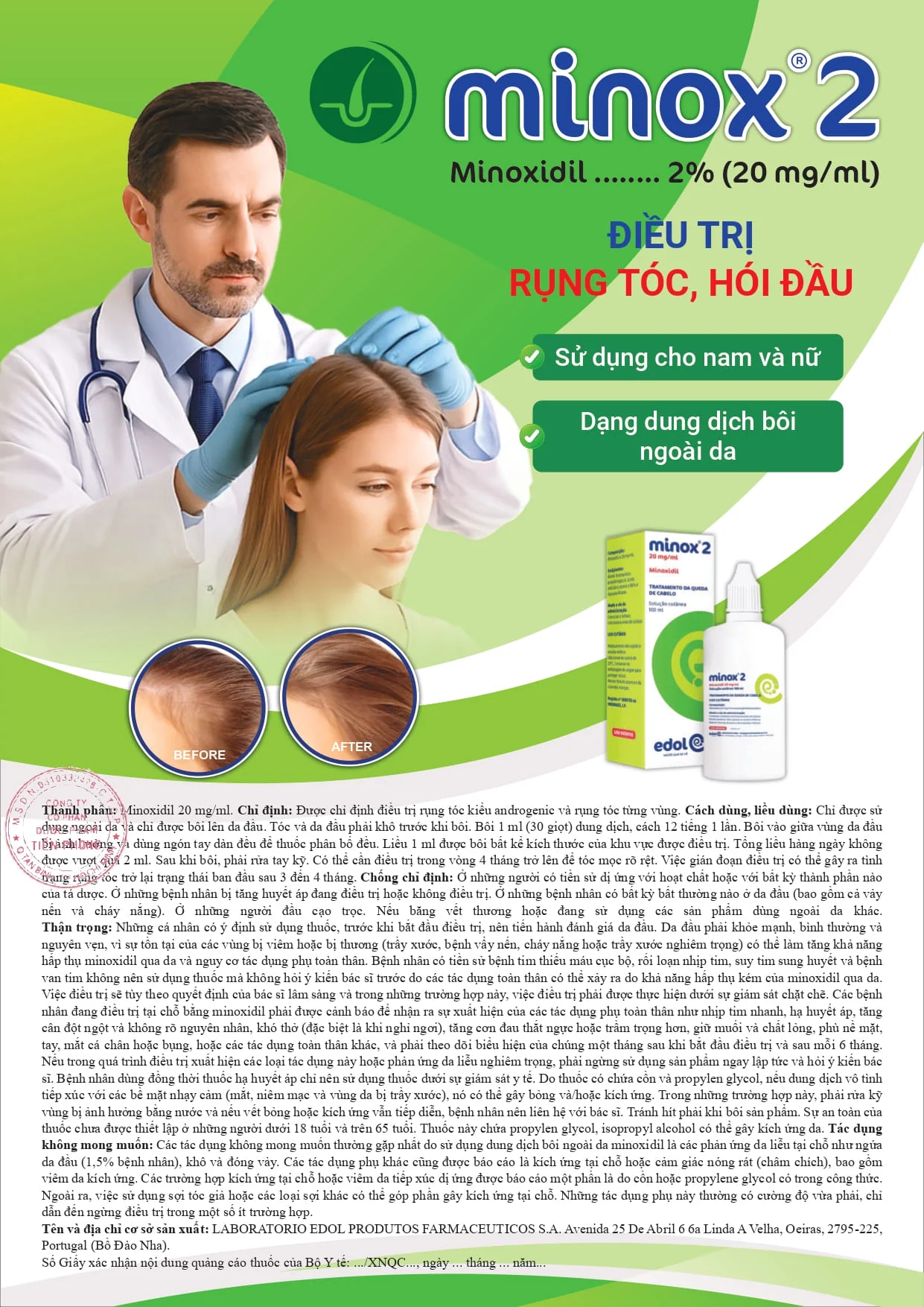 Minox2-dieu-tri-rung-toc-1