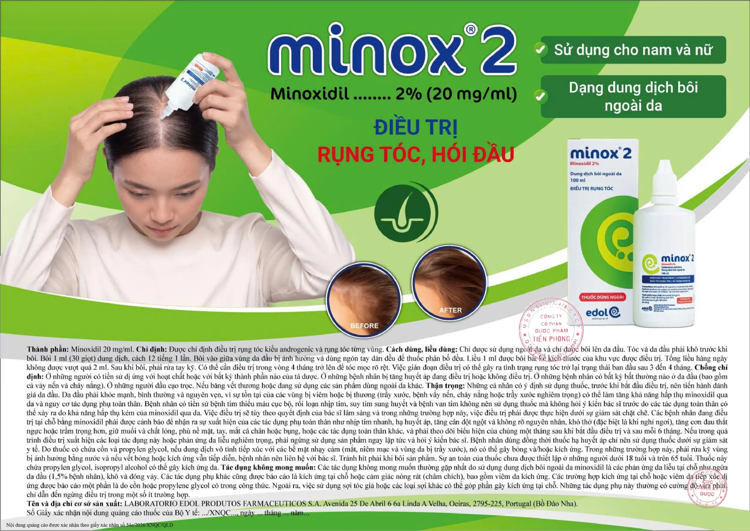 Minox2-dieu-tri-rung-toc