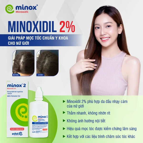 Minox2 thường được chỉ định cho nữ giới, phù hợp với da đầu nhạy cảm, giúp hạn chế kích ứng