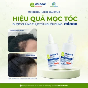 Minox-dieu-tri-rung-toc