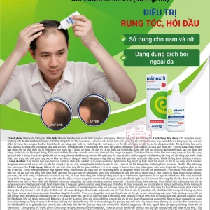 Minox5-dieu-tri-rung-toc