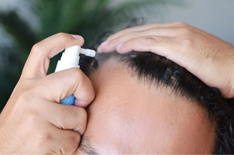 Tùy thuộc vào đầu phun dùng với lọ thuốc mà có cách dùng Minoxidil khác nhau
