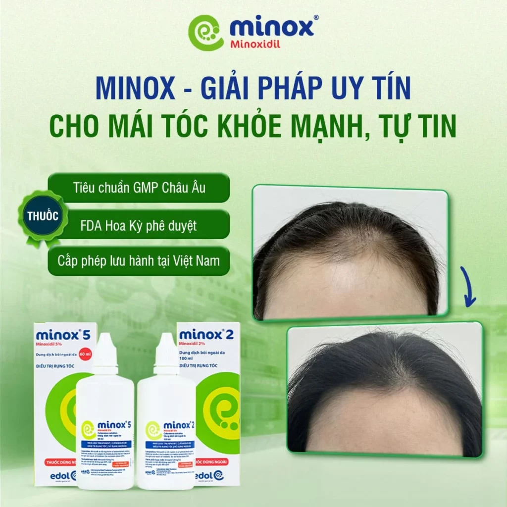 Minox-tri-rung-toc (1)