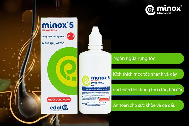 Sản phẩm Minox 5 giúp kích thích mọc tóc, ngăn ngừa hói đầu và chăm sóc da đầu tối ưu