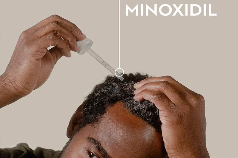 Cần chú ý các tác dụng phụ khi dùng Minoxidil về tim mạch, huyết áp, tăng cân đột ngột, kích ứng da...