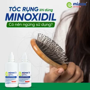Minoxidil-gay-rung-toc