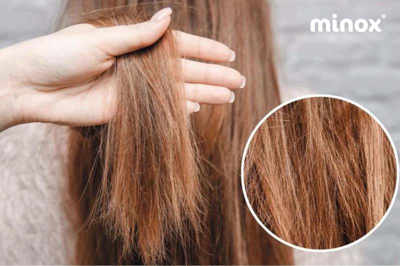 Tóc khô xơ, chẻ ngọn do thiếu sắt, kẽm, protein và vitamin C trong chế độ ăn