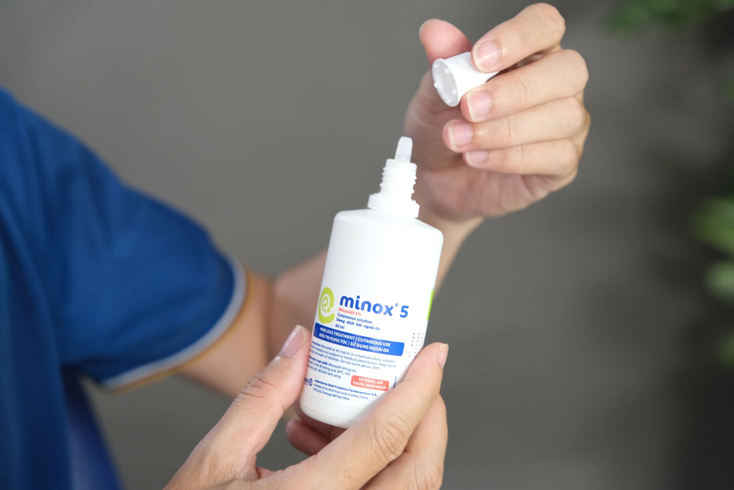 Hiệu quả của Minox duy trì ổn định trong suốt thời gian điều trị rụng tóc
