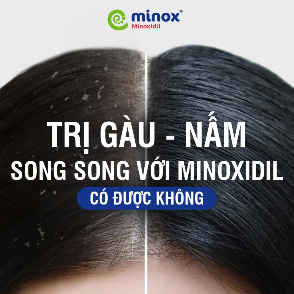 Minoxidil-gau-nam-da-dau