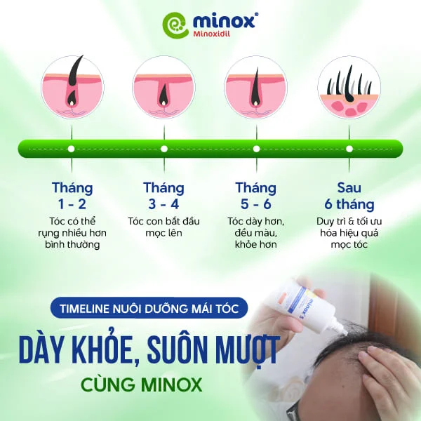 Minoxidil-tri-rung-toc (1)