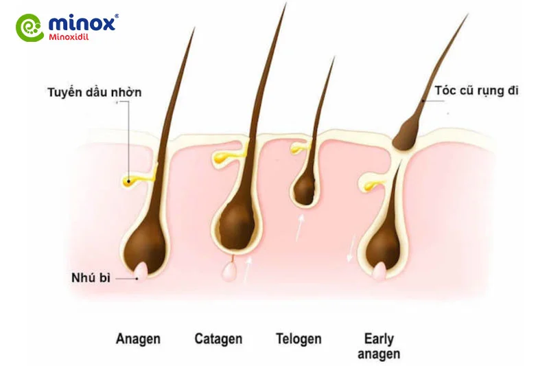 Nang tóc suy yếu, tổn thương sẽ không thể tạo ra sợi tóc mới khỏe mạnh