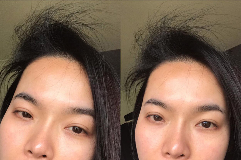 Tóc con mọc nhiều là dấu hiệu tích cực cho thấy tóc đang trong quá trình phục hồi và tái tạo