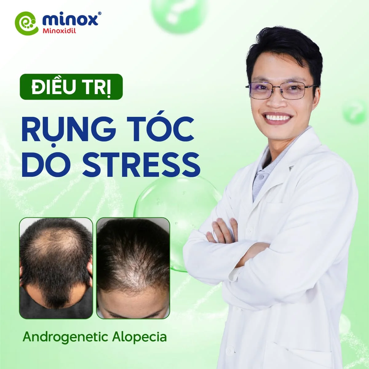 Minoxidil-stress (1)