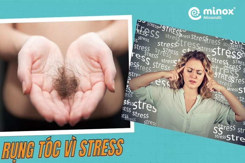 Khi bị stress nghiêm trọng, nhiều nang tóc bước vàogiai đoạn nghỉ sớm hơn bình thường, dẫn đến rụng tóc