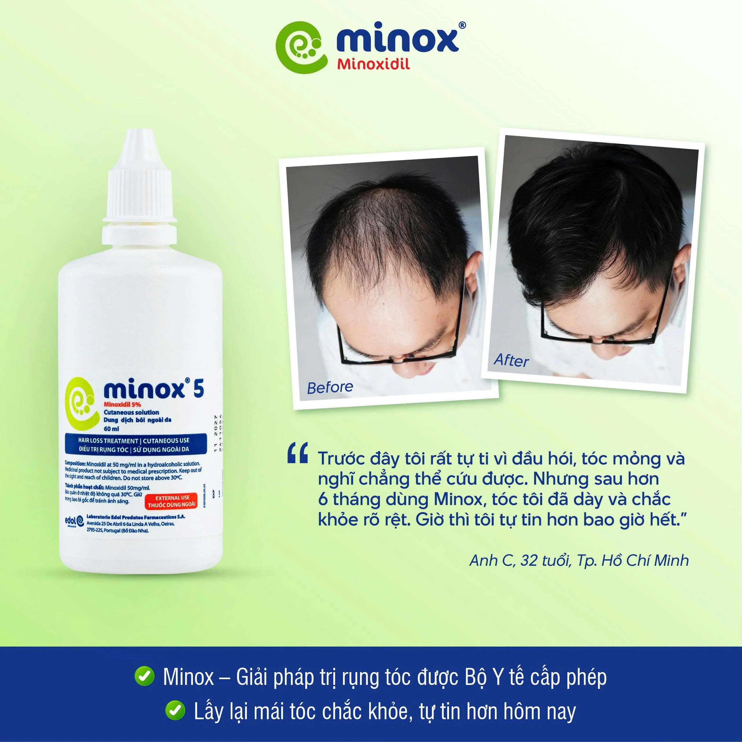 Việc sử dụng khi da đầu khô là rất quan trọng để Minoxidil đạt hiệu quả tốt nhất