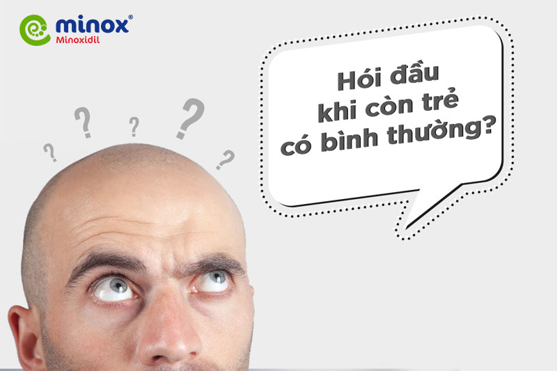Hói đầu gây ảnh hưởng lớn đến ngoại hình, khiến bạn trông già đi nhiều so với tuổi