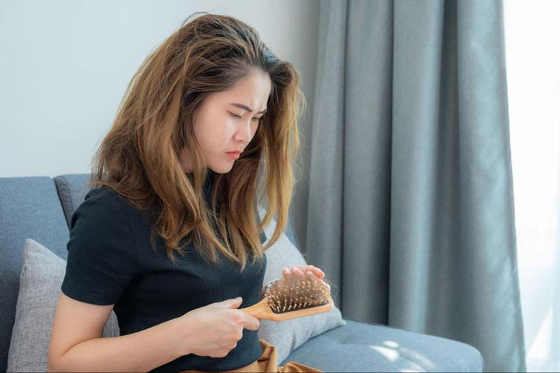 Rụng tóc nội tiết ảnh hưởng nghiêm trọng đến tâm lý và ngoại hình của người trẻ
