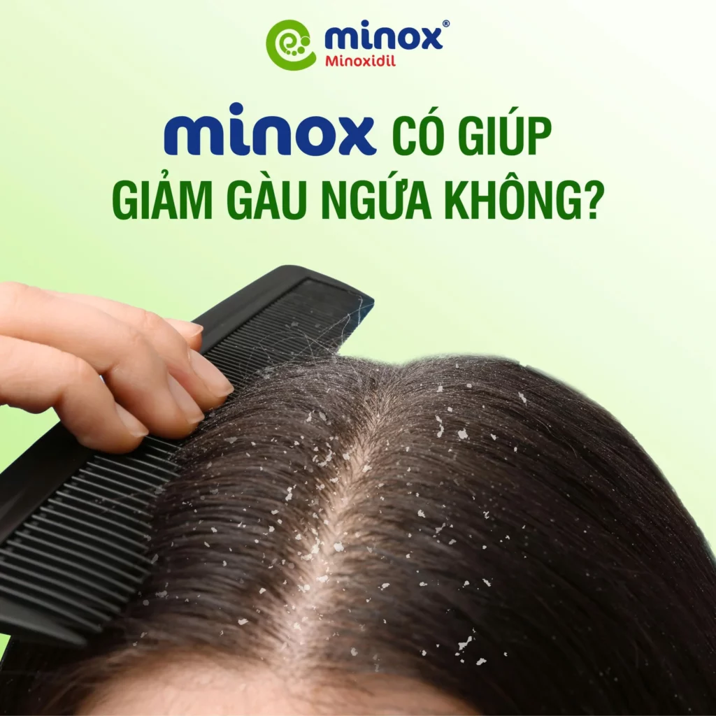 Minox-giam-gau-ngua