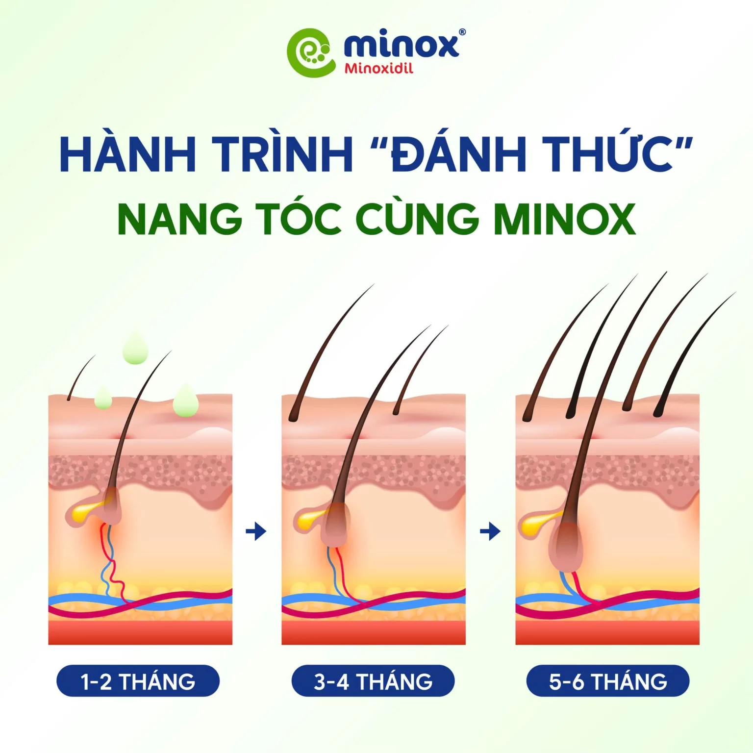 Minox-nang-toc-1