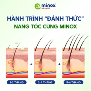 Minox-nang-toc-1