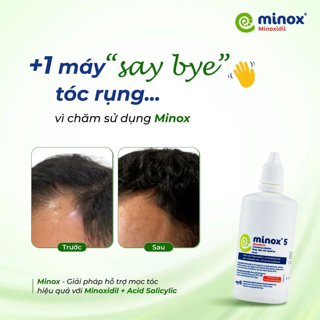 Minoxidil
