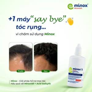 Minoxidil