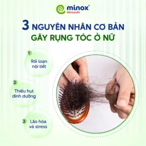 Nguyen-nhan-rung-toc-nu-gioi