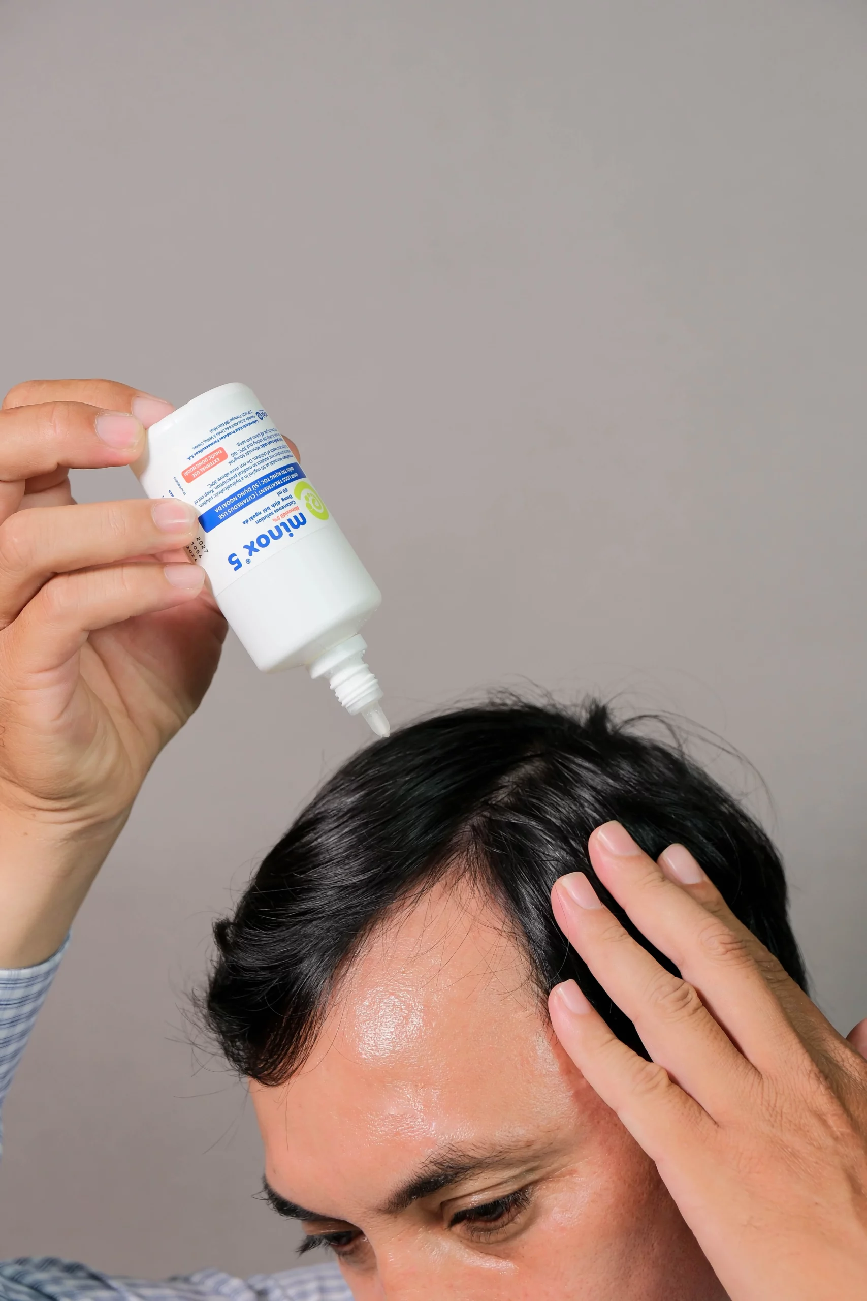 Minox có hiệu quả điều trị rụng tóc, thường ở nồng độ 2% (phổ biến cho nữ, rụng tóc nhẹ/trung bình) and 5% (nam giới, rụng tóc nặng hơn), dùng bôi ngoài da 2 lần/ngày