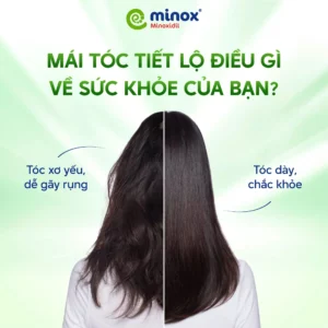 Minox-suc-khoe-toc