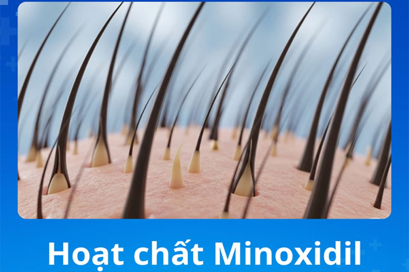 Minoxidil kéo dài pha mọc của sợi lông, kích thích nang lông phát triển, giúp lông mày trở nên rõ nét và dày khỏe hơn