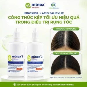 Minoxidil-acid-salicylic-dieu-tri-rung-toc