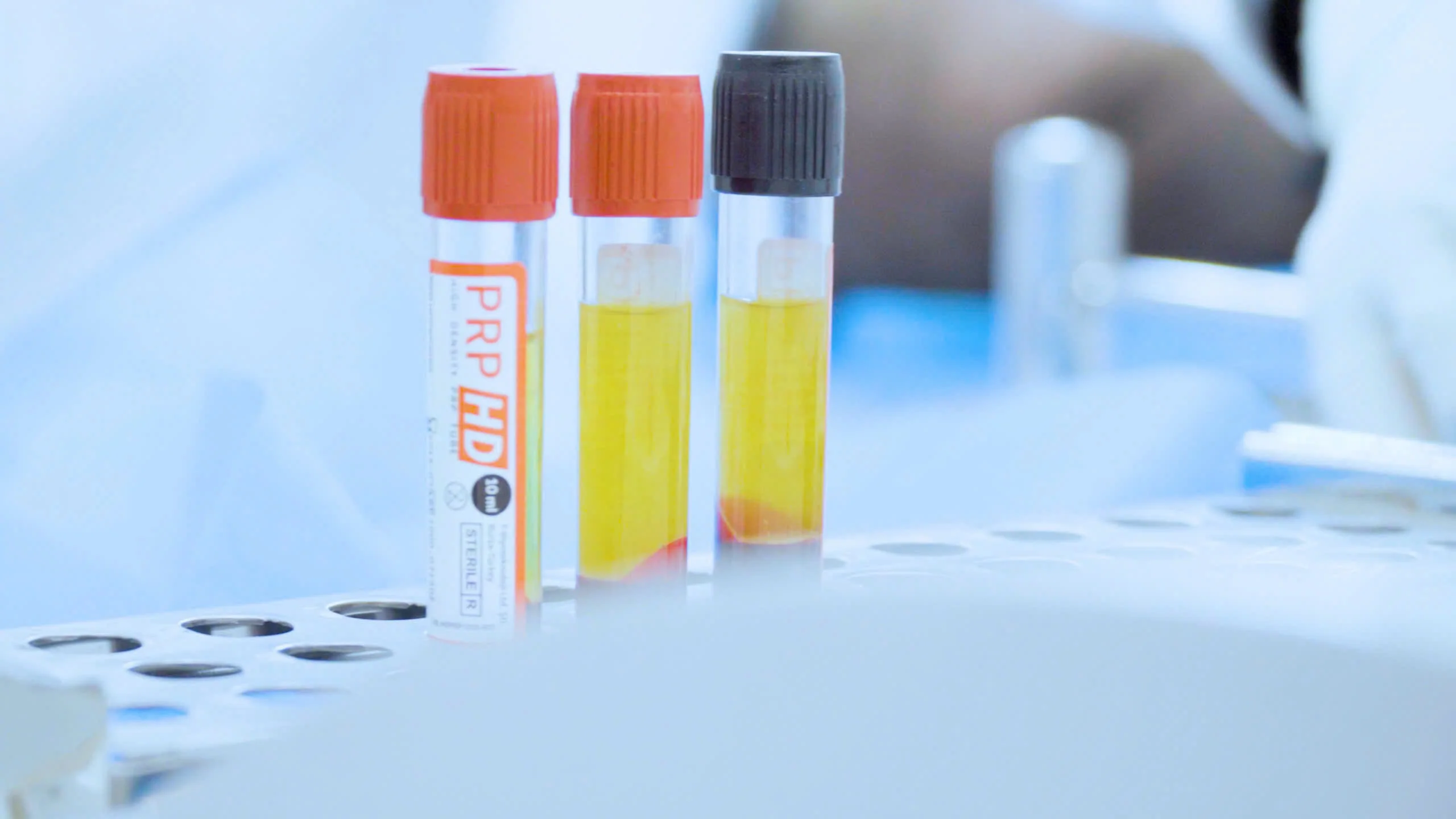 PRP giúp tăng lưu lượng máu tới nang tóc, kích thích các nang tóc mới phát triển, kéo dài giai đoạn mọc tóc