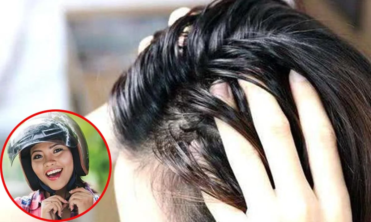 Đội mũ bảo hiểm nhiều, đặc biệt vào mùa hè nắng nóng, có thể khiến tóc bạn dễ bết dính, khô xơ và gãy rụng